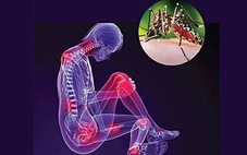Dịch Chikungunya lan rộng liệu có nguy hiểm?