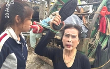 2 công nhân vệ sinh Đà Lạt bị hành hung phải nhập viện