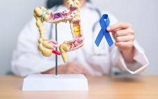 5 dấu hiệu ung thư đại tràng phổ biến thường bị bỏ qua