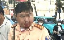 Đang làm nhiệm vụ, trung tá cảnh sát giao thông bị người đàn ông nước ngoài đấm vào miệng