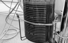 Sau nâng ngực 5 năm, cô gái gặp biến chứng, hút ra hơn 2 lít dịch và silicon