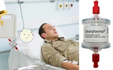 Thiết bị lọc huyết tương giúp ngăn tình trạng xuất huyết cấp tính