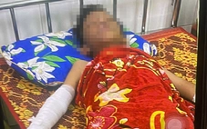 Học sinh lớp 5 ở Quảng Trị bị thương nghi do pháo tự chế nổ