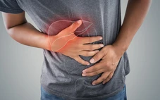 Gan - cơ quan dễ bị tổn thương khi mắc sốt xuất huyết