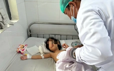 Lấy búi tóc lớn gây tắc ruột bé gái 4 tuổi mắc hội chứng 'công chúa tóc mây' ở Cần Thơ