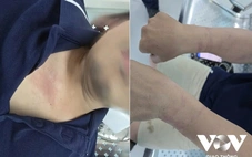 Lãnh đạo VOV Giao thông: 'Việc còng tay phóng viên đang tác nghiệp như tội phạm là bất thường'