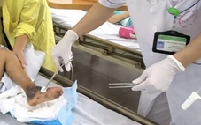 Đắp thuốc nam chữa vết mèo cắn, bé trai 4 tuổi nguy kịch