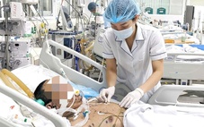 Lây thủy đậu từ con gái, người đàn ông 36 tuổi nhập viện nguy kịch