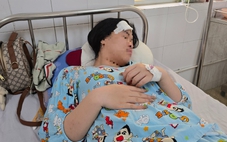 Phản ứng hành vi khiếm nhã, cô gái bị người đàn ông đánh tét đầu trong quán cà phê