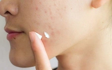 Một công ty bị thu hồi, đình chỉ lưu hành 77 loại mỹ phẩm