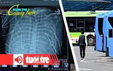 Điểm tin cùng bạn 8h: Sống sót 48 giờ dù không còn phổi; Giới trẻ Hàn Quốc đổ xô làm tài xế xe buýt