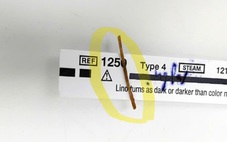 Nuốt que xiên nhỏ gây hậu quả lớn