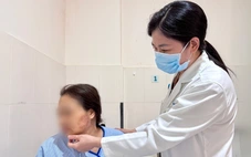 Nhập viện do trị nhức mỏi bằng chích lể, giác hơi