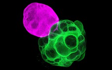 Lần đầu tái tạo được mạch não người trong phòng thí nghiệm