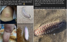 'Bé 3 tuổi bị rết biển cắn cần máu hiếm' gây 'bão' chia sẻ: Hóa ra là tin vịt
