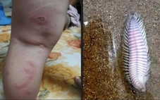 'Bé 3 tuổi bị rết biển cắn cần máu hiếm' gây 'bão' chia sẻ: Hóa ra là tin vịt