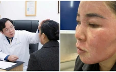 Đang gội đầu được mời ‘làm đẹp cấp tốc’ đón Tết, cô gái hỏng cả khuôn mặt