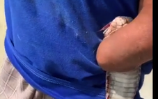 Cụ ông cụt tay kẹp rắn hổ mang nhận hơn 300 triệu đồng, gia đình xin dừng nhận hỗ trợ