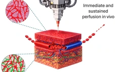 Phát triển mô cấy ghép in 3D giúp phục hồi tổn thương mô nghiêm trọng