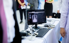 Gánh nặng bệnh lao ở Việt Nam 'đứng top' thế giới, lên kế hoạch phòng chống