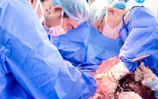 Mổ khối u xơ tử cung to như bụng bầu song thai những tuần cuối