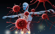 Tại sao thuốc điều trị ung thư tác dụng không đều với các bệnh nhân?