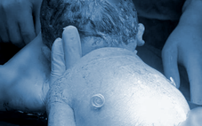 Em bé sinh ra với ‘đôi cánh nhỏ’ trên lưng mẹ