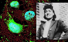 Người phụ nữ qua đời 70 năm nhưng 'tế bào bất tử' vẫn cứu hàng triệu người