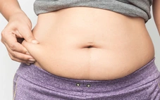 Béo phì không chỉ do 'ăn nhiều - ít vận động'