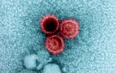 Hé lộ bí mật vi rút ‘ngủ đông’ cả đời trong cơ thể người mà không phát bệnh