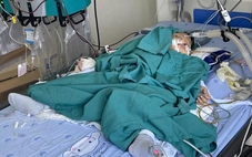 Bé 2 tuổi ngộ độc nặng sau khi nuốt vật màu xanh anh trai mang từ trường về