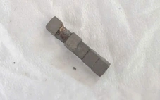 Cấp cứu bé trai nuốt phải nhiều viên nam châm