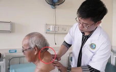 Phẫu thuật bóc khối u 'khổng lồ' vùng sau cổ suốt hơn 40 năm cho cụ ông 72 tuổi