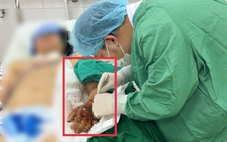 Người phụ nữ nguy kịch sau khi tiêm thuốc ở phòng khám tư