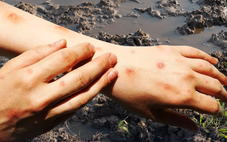 Cảnh giác 'sốt đất' - căn bệnh xuất hiện từ bùn đất