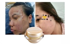 Phát hiện công ty ở TP.HCM sản xuất mỹ phẩm chứa chất cấm Dexamethason, tiêu hủy 107 lô