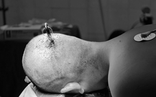 Cảnh báo tai nạn học đường từ những trò đùa nghịch thiếu kiểm soát