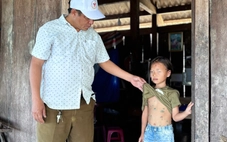 Phát hiện 26 ca thủy đậu trong trường học, Đắk Lắk khẩn trương dập dịch