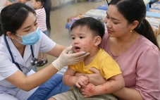Tay chân miệng ở Đà Nẵng tăng nhanh, vượt ngưỡng trung bình nhiều năm