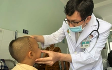 Bé trai 4 tuổi bị viên bi sắt găm vào hố sọ do nghịch ná bắn chim