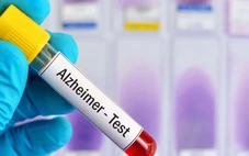 Bộ xét nghiệm máu mới giúp phát hiện sớm bệnh Alzheimer