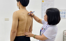 Bác sĩ cảnh báo dấu hiệu đau lưng bất thường không nên bỏ qua