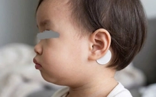 Nguy hiểm miếng dán chống say tàu xe, nhiều người chưa biết