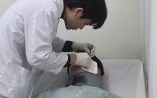 Tiêm filler tạo hình tai, ba năm sau cô gái 24 tuổi bị viêm nhiễm, áp xe