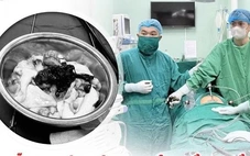 Đừng để đau bụng làm mất khả năng sinh sản