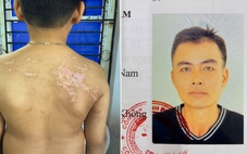 Khởi tố người cha đánh con ruột gây thương tích 36%