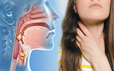 Triệu chứng ung thư vòm họng dễ nhầm với viêm họng, viêm xoang
