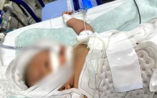 Bệnh viện Nhi đồng TP Cần Thơ lần đầu dùng kỹ thuật hạ thân nhiệt chỉ huy chữa trẻ sơ sinh bị thiếu oxy não