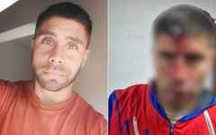 Cầu thủ người Argentina bị đâm thủng hộp sọ khi đến xem trận đấu bóng đá của con gái