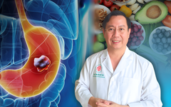 Bác sĩ Viện Phẫu thuật tiêu hóa hướng dẫn cách ăn uống ngừa ung thư dạ dày